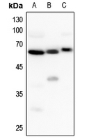 1 - Anti-UGT8 Antibody AP51985