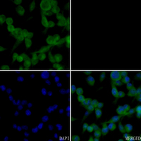 3 - Anti-C-Reactive Protein Antibody AP51986