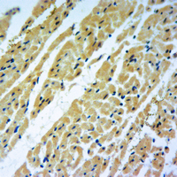 19 - Anti-C-Reactive Protein Antibody AP51986