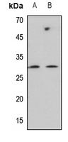 1 - Anti-C-Reactive Protein Antibody AP51986