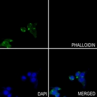 3 - Anti-GOT1 Antibody [KO/KD Validated] AP51988