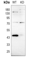 0 - Anti-GOT1 Antibody [KO/KD Validated] AP51988