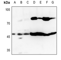 1 - Anti-GOT1 Antibody [KO/KD Validated] AP51988