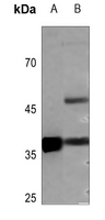 1 - Anti-Podoplanin Antibody AP51992