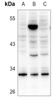 1 - Anti-SRD5A1 Antibody AP51995