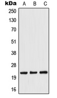 1 - Anti-TWIST Antibody AP51996