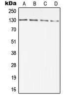 1 - Anti-DIAPH2 Antibody AP51997