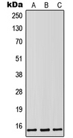 1 - Anti-Lutropin beta Antibody AP51998