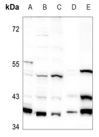1 - Anti-GNAI1 Antibody AP51999