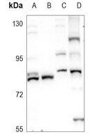 1 - Anti-SLC22A2 Antibody AP52001