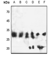 1 - Anti-EB3 Antibody AP52003