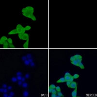 3 - Anti-EIF5A Antibody AP52004