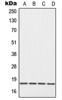 1 - Anti-EIF5A Antibody AP52004