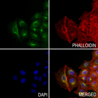 3 - Anti-ENDOG Antibody AP52005