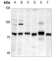 1 - Anti-FARSB Antibody AP52006