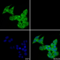 3 - Anti-FHL2 Antibody AP52007