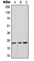 1 - Anti-GSTM1 Antibody AP52008