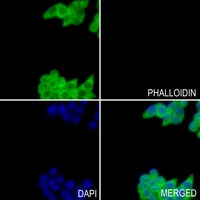 3 - Anti-GSTM2 Antibody AP52009