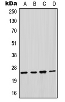 1 - Anti-GSTM2 Antibody AP52009