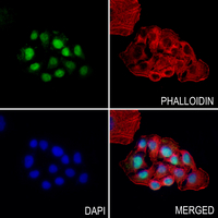 3 - Anti-HIC2 Antibody AP52010
