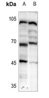 1 - Anti-HIC2 Antibody AP52010