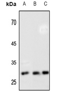 1 - Anti-HOXB7 Antibody AP52011