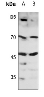 1 - Anti-SOX11 Antibody AP52016