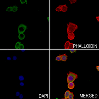 3 - Anti-TRPM8 Antibody AP52018