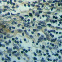 19 - Anti-TRPM8 Antibody AP52018