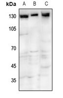 1 - Anti-TRPM8 Antibody AP52018