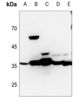 1 - Anti-MDH1 Antibody AP52021