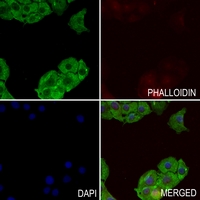 3 - Anti-Semaphorin 3E Antibody AP52023