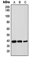 1 - Anti-Thrombopoietin Antibody AP52026
