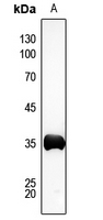 1 - Anti-AKR1C2 Antibody AP53284