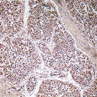 19 - Anti-ATP5C1 Antibody AP53285
