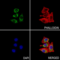 3 - Anti-ATP5I Antibody AP53286