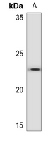1 - Anti-BNIP3 Antibody AP53287