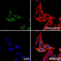 3 - Anti-Complement C1S Antibody AP53288