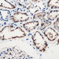 19 - Anti-Complement C1S Antibody AP53288