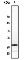 1 - Anti-CBFB Antibody AP53289