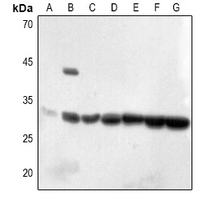 1 - Anti-ECI1 Antibody AP53297