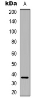 1 - Anti-FAM84B Antibody AP53298
