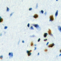 19 - Anti-FOXE3 Antibody AP53299