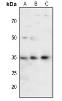 1 - Anti-FOXE3 Antibody AP53299