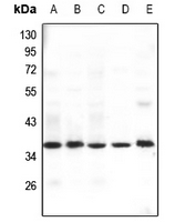 1 - Anti-GHITM Antibody AP53301