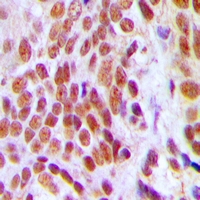 19 - Anti-HMGB2 Antibody AP53302