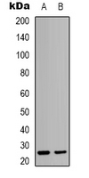 1 - Anti-HMGB2 Antibody AP53302