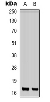 1 - Anti-CD225 Antibody AP53303