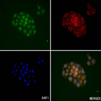 3 - Anti-Kallikrein 3 Antibody AP53304