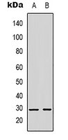 1 - Anti-Kallikrein 3 Antibody AP53304